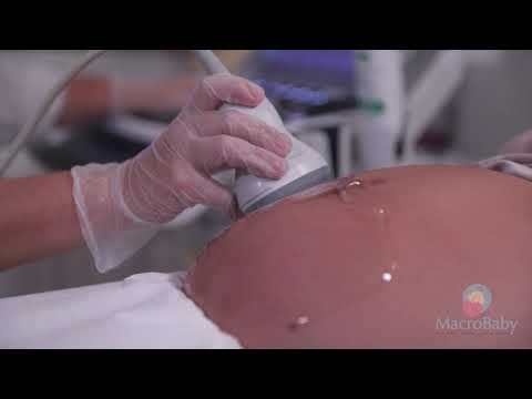 4D HD Ultrasound Scan in Orlando, FL | MacroBaby