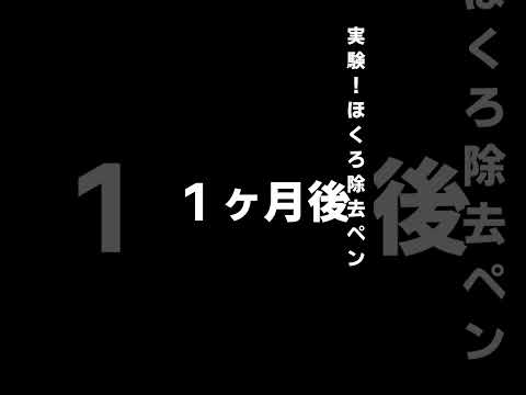 実験!怪しげなホクロ除去ペン2500円#shorts