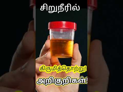 சிறுநீரில் கிருமித்தொற்று அறிகுறிகள் | #urineinfection | #urineinfectiontamil | #urineproblemtamil