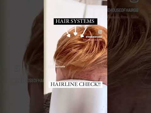 Hair System #wig #hairloss #wigsfirmen #wigs