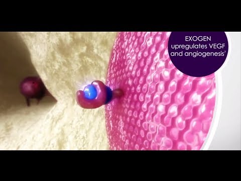 EXOGEN MOA Video - International