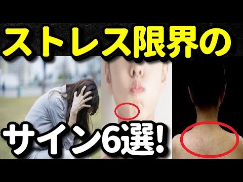 ストレス限界のサイン６選！ストレス過剰になると身体に現れる症状・前兆とは？今すぐ確認！知ってよかった健康雑学