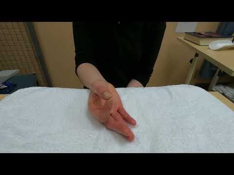 Hand injury exercise 14: Active thumb opposition