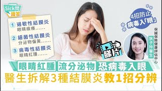 Sick問識答｜眼睛紅腫流分泌物恐病毒入眼  醫生拆解3種結膜炎教1招分辨｜附4大護眼法則