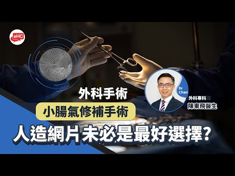 外科手術｜小腸氣修補手術｜人造網片未必是最好選擇?