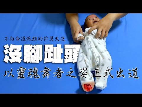 沒腳趾頭Ｘ帥到分手｜不向命運低頭的折翼天使｜慎入!! 內有血腥畫面