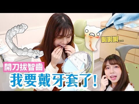 今天起我戴牙套啦! 誰還要罵我嘴凸暴牙 😡😈 ?! / 海恩