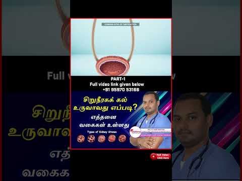 KIDNEY STONE FORMATION AND STONE TYPES | சிறுநீரகக் கல் உருவாவது எப்படி? எத்தனை வகைகள் உள்ளது