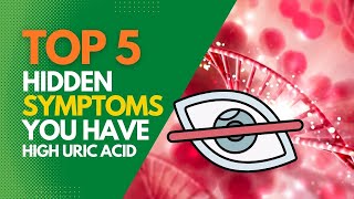 5 Hidden Symptoms You Have High Uric Acids