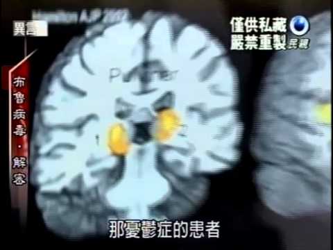 20121110 民視異言堂 憂鬱症解密大腦的疾病 1