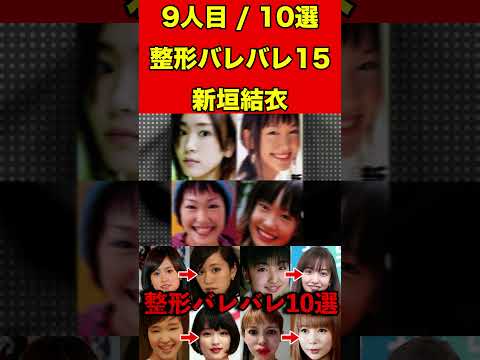 新垣結衣15整形がバレバレな芸能人！10選 #芸能界の闇 #ゴシップ #整形 #芸能人 #噂話 #有名人  #雑学 #モデル #芸能 #女優 #アイドル #美容