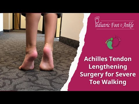 Achilles Tendon Lengthening Surgery for Severe Toe Walking