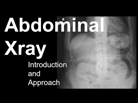 Abdominal Xray: Introduction and Approach