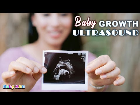 What to Expect During a Baby Growth Ultrasound || Pregnancy Scan || What to expect in Growth scan?