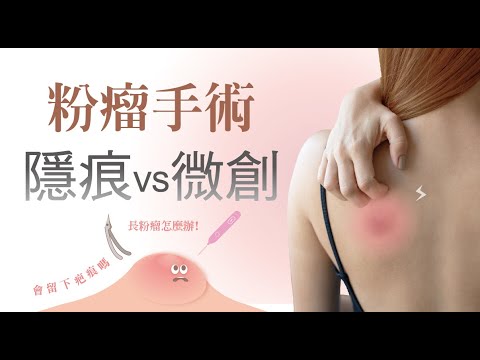 微創粉瘤 跨海尋求治療 ! 香港➡台灣-極緻美型·文心極緻美型皮膚科診所整形手術-林子鈞醫師：台中粉瘤_粉瘤手術_微創粉瘤_粉瘤健保