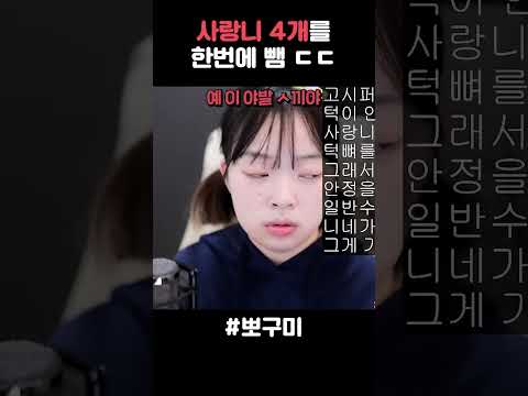 사랑니 4개를 한 번에 뺌 ㄷㄷ