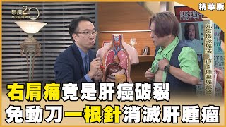 「右肩痛」竟是肝癌破？名醫揭「一根針」消滅3公分肝腫瘤！【聚焦2.0】第520集