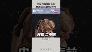 【諾雅美研所】皮膚鬆弛救星，超能電漿來了！新一代微創拉皮，超能電漿注意事項一次告訴你【李昱恆醫師】#shorts