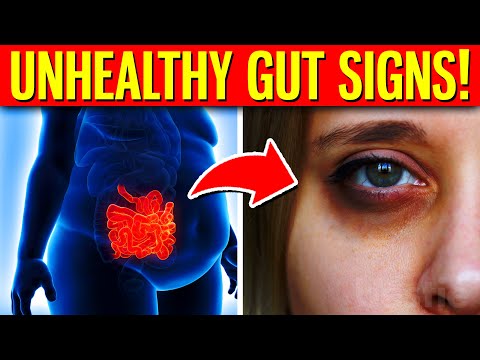 10 Warning Signs You Have An UNHEALTHY Gut