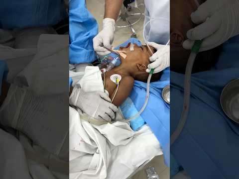 Boy wakes up after 5hour surgery