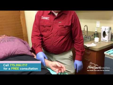 Thumb Tendinitis - Reno Sparks MedSpa - Dr. Calvin Van Reken