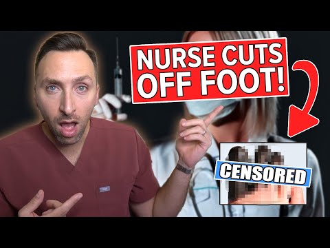 Nurse Amputates Patient's Foot WITHOUT Permission