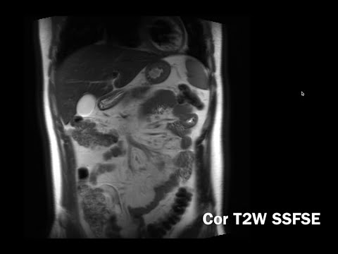 Introduction to Abdominal MRI: Background, Pulse Sequences, Normal Appearance (Body MRI, Abdo MRI)