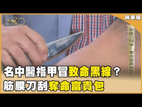 名中醫指甲有黑線！已觀察15年！ 筋膜刀伺候！奪命富貴包怎處理？【聚焦2.0】第553集