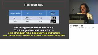 Retreatment in AMD OCTA versus Bmode OCT