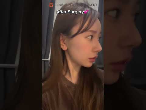 Is she a K-pop idol?😍  #rhinoplasty #facialcontouringsurgery #fyp #glowup #plasticsurgeryinkorea