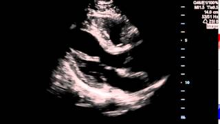 Cardiac Imaging (B-Mode)