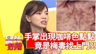 手掌出現咖啡色點點？竟是「梅毒」找上門？！【醫師好辣】 20190521 part3 EP743 陳欣湄 高伊玲