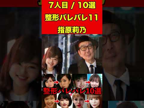 指原莉乃11整形がバレバレな芸能人！10選 #芸能界の闇 #ゴシップ #整形 #芸能人 #噂話 #有名人  #雑学 #モデル #芸能 #女優 #アイドル #美容