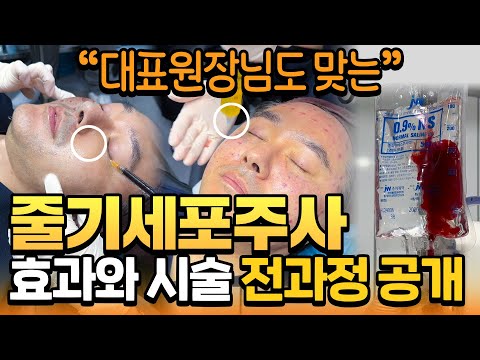 피부과 줄기세포주사 효과와 시술 전과정 공개 🌟_ ㅣ모즈의원- 모즈클리닉