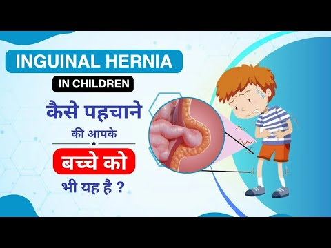 Inguinal Hernia in Children - Causes, Symptoms & Treatment | बच्चों में अंडकोष हर्निया - लक्षण, कारण