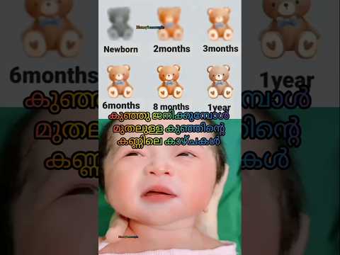 You know thise 🤔🤔🤔കുഞ്ഞിന്റെ കണ്ണിന്റെ കാഴ്ചയിങ്ങനെ 👩‍🍼👩‍🍼#youtubeshorts #baby #postpartum #shorts