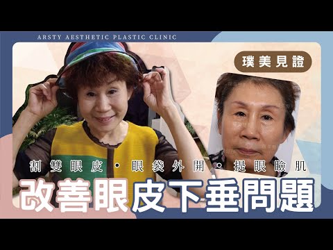 【割雙眼皮．眼袋外開．提眼肌】一站式逆齡改造 | 璞美整形外科醫美診所