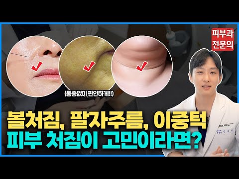 통증은 없고 효과는 두배!, 현존하는 가장 최신의 "리프팅 레이저"