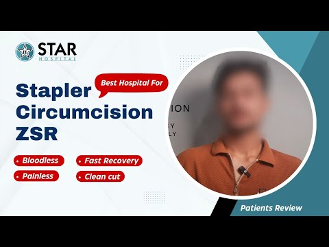 Stapler Circumcision ZSR Mohali Punjab | Best Hospital Bloodless Painless Fast Recovery Clean cut