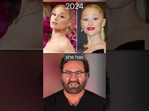 Ariana Grande NEW Face | Plastic Surgeon Reacts