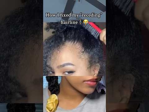 How I fixed my RECEDING hairline #curlyhair #naturalhair #hairstyles