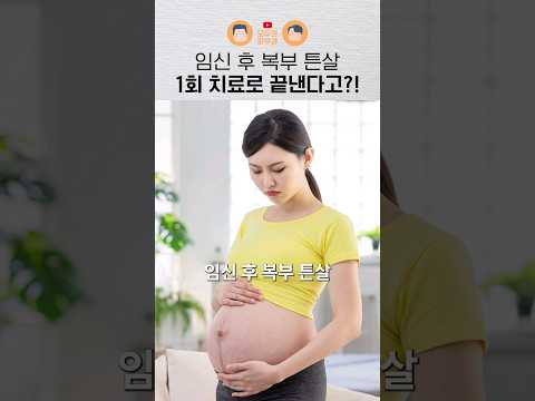 임신 후 복부 튼살에 가장 효과적인 치료는?