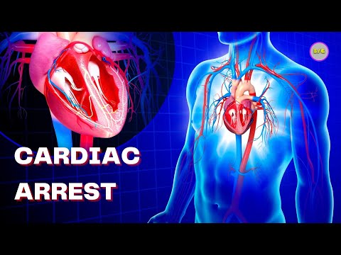 CARDIAC ARREST #shorts #puneethrajkumar #heartdisease #healthcare #heartattack #cardiac #CPR #ecg