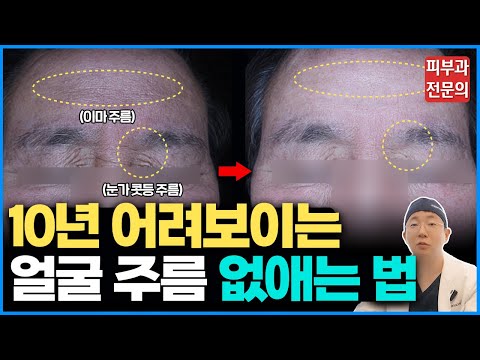 10년지나도 늙지 않는 주름살 제대로 관리하는 방법 / 16년차 청담동 피부과 전문의 오가나