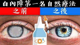 (眼睛12) 白內障的第一名自然療法,柏格醫生 Dr Berg