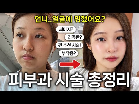 피부과 시술 & 얼굴 관리 총정리🔥 돈 절대 안 아까운! 추천 vs 비추천? 홈케어 꿀템? 망한 부작용썰...💉