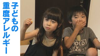 お菓子で治す！? “卵焼きの味を知らない少女たち” ‥子どもの食物アレルギーとどう向き合うか。CBCテレビ　ドキュメンタリー