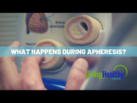 Managing Cholesterol With Apheresis