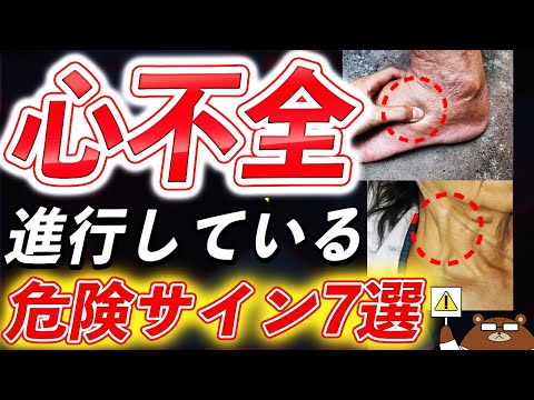 【危険】知らないと後悔する心不全の危険サイン7選。日本で急増している理由とは？こんな人がリスク大。意外に知られていない心不全の初期症状と予防法・心臓を守る対策を医師が完全解説！