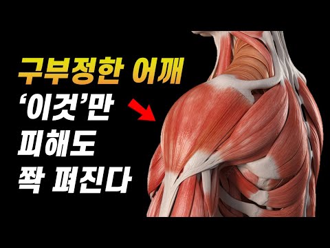 라운드 숄더 '이 습관' 안 고치면.. 굽은 등 더 구부러진다